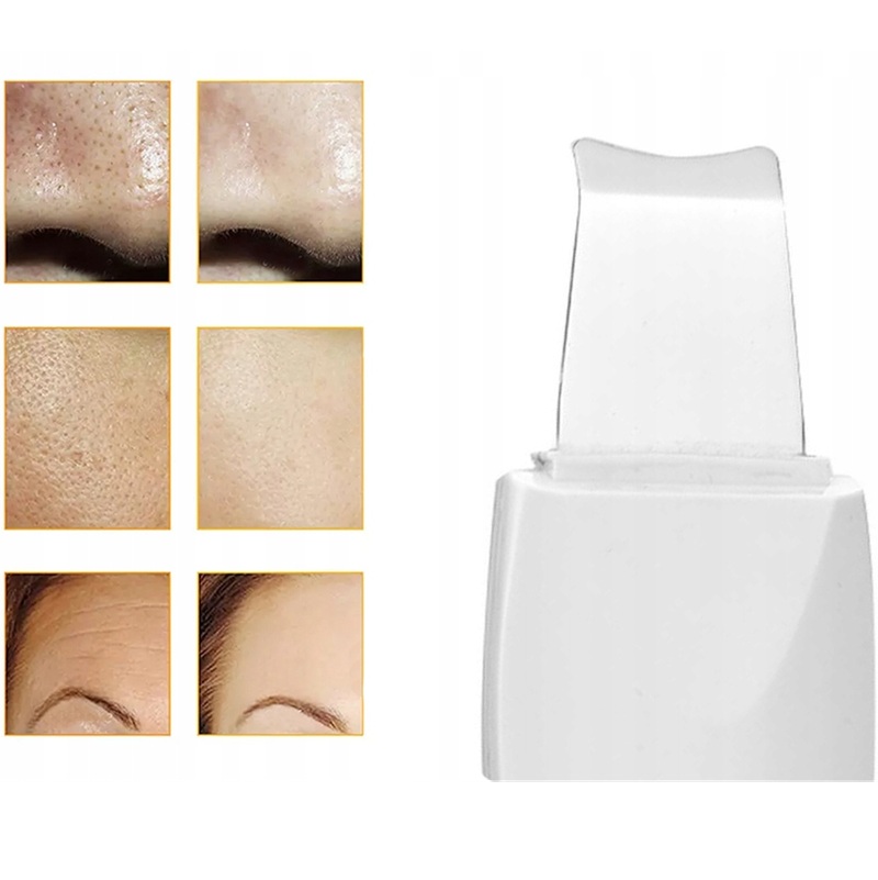 Ultrazvuková špachtľa na pokožku